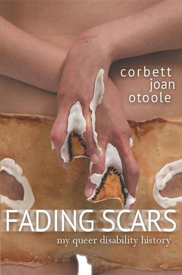 Fading Scars: My Queer Disability History - Corbett Joan OToole - Elizabeth Grace