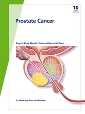 Fast Facts: Prostate Cancer