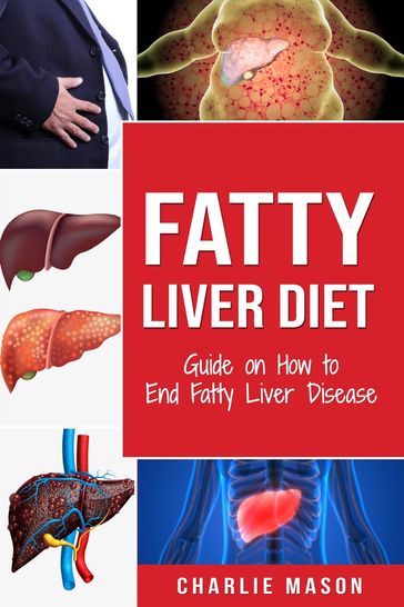 Fatty Liver Diet: Guide on How to End Fatty Liver Disease - Charlie Mason