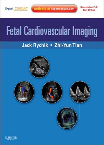 Fetal Cardiovascular Imaging: A Disease Based Approach - MD  FACC Jack Rychik - MD  RDCS Zhiyun Tian