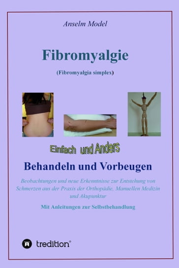 Fibromyalgie (Fibromyalgia simplex) einfach und anders behandeln und vorbeugen - Anselm Dr.Dr. Model