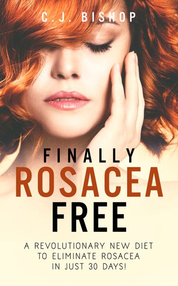 Finally Rosacea Free - C.J. Bishop