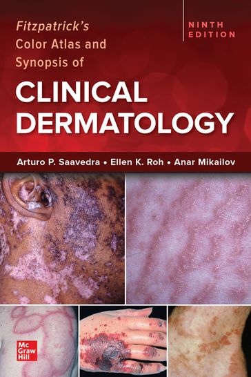 Fitzpatrick's Color Atlas and Synopsis of Clinical Dermatology, 9/e - Arturo Saavedra - Ellen K. Roh - Anar Mikailov