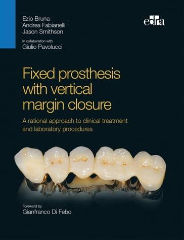 Fixed prosthesis with vertical margin closure - Ezio Bruna - Andrea Fabianelli - Jason Smithson