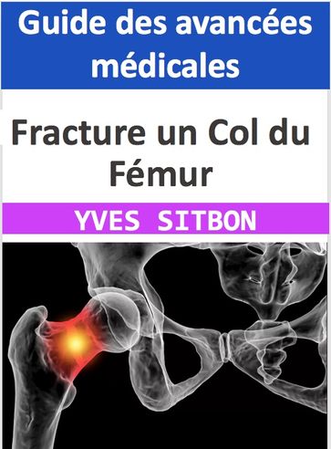 Fracture un Col du Fémur : Guide des avancées médicales - YVES SITBON