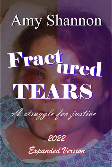 Fractured Tears: A Struggle for Justice - Amy Shannon