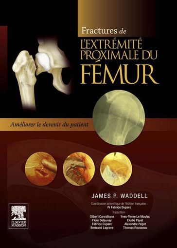 Fractures de l'extrémité proximale du fémur - Fabrice Duparc - James P. Waddell