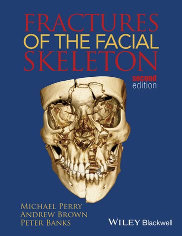 Fractures of the Facial Skeleton - Michael Perry - Andrew Brown - Peter Banks