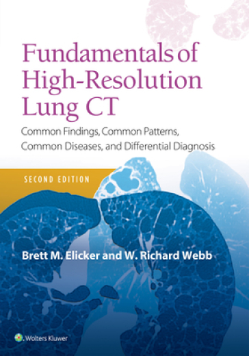 Fundamentals of High-Resolution Lung CT - Brett M Elicker - W. Richard Webb