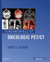 Fundamentals of Oncologic PET/CT