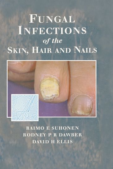 Fungal Infections of the Skin and Nails - Raimo E. Suhonen - Rodney P.R. Dawber - David H. Ellis