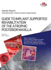 GUIDE TO IMPLANT-SUPPORTED REHABILITATION OF THE ATROPHIC POSTERIOR MAXILLA