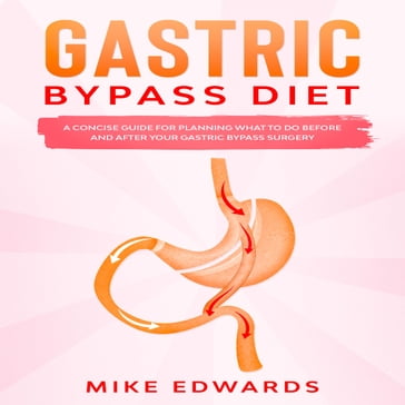 Gastric Bypass Diet: A Concise Guide for Planning What to Do Before and After your Gastric Bypass Surgery - Mike Edwards