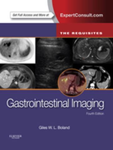 Gastrointestinal Imaging: The Requisites E-Book - Giles W Boland - MD - FACR