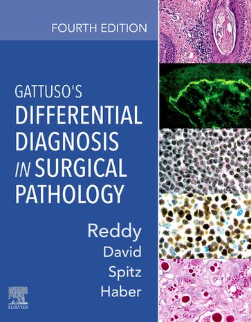 Gattuso's Differential Diagnosis in Surgical Pathology - MD  MBA Vijaya B. Reddy - MD  MPH Odile David - MD Daniel J. Spitz - MD Meryl H. Haber