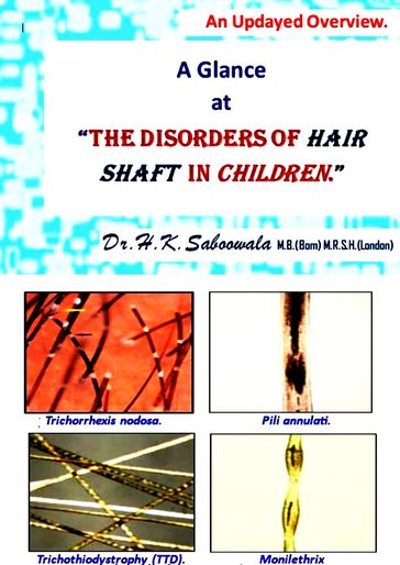 A Glance at "The Disorders of hair shaft in Children." An Updated Overview. - Dr. Hakim. K. Saboowala