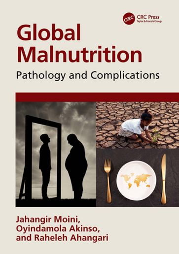 Global Malnutrition - Jahangir Moini - Oyindamola Akinso - Raheleh Ahangari