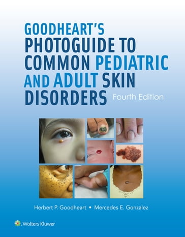 Goodheart's Photoguide to Common Pediatric and Adult Skin Disorders - Herbert Goodheart - Mercedes Gonzalez