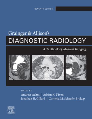 Grainger & Allison's Diagnostic Radiology, 2 Volume Set E-Book - MD  PhD Cornelia Schaefer-Prokop - CBE  MB  BS(Hons)  PhD  FRCP  FRCR  FRCS Andy Adam - MD  FRCP  FRCR  FRCS Adrian K. Dixon - BSc  MA  MD  FRCR  FRCP  MBA Jonathan H Gillard