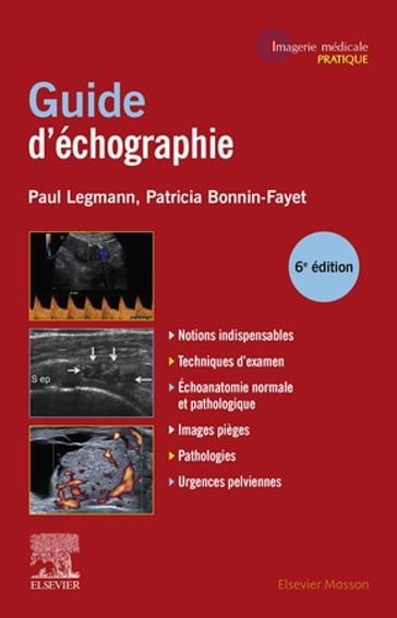 Guide pratique d'échographie - Paul Legmann - Patricia Bonnin-Fayet - Olivier Lucidarme - Jean-Philippe Dillenseger - Joelle Uzan-Augui - Franck Lapègue - Christophe Delavaud - Isabelle Mourey-Gerosa - Gloria Bettini - Olivia Anselem - Jonathan Dbjay - Nathalie Launay - Ahmed Khairoune - Carla Clodine-Florent - Moncef BEN ARFI - Alexandre Schull - Marie Faruch-Bilfeld - Olivier Hélénon - Khalil Meddeber - Nicolas Sans - Marie Bienvenu-Perrard - Jean-Michel Correas - Chiara SILEO - Hubert Ducou Le Pointe