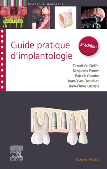 Guide pratique d'implantologie - Benjamin Pomès - Patrick Goudot - Jean-Pierre Lacoste - Timothée Gellée - Jean-Yves Doukhan - Mickael Samama - Alain Béry - Norbert Bellaiche - Nicolas COHEN - LOCKHART - Fani Anagnostou