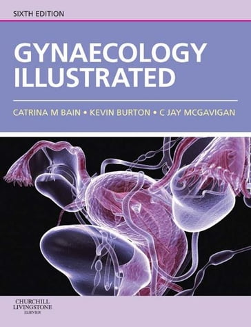 Gynaecology Illustrated E-Book - MBChB  MRCOG Catrina Bain - MD MRCOG Kevin Burton - MBBS  MD  MRCOG  FRANZCOG Jay McGavigan