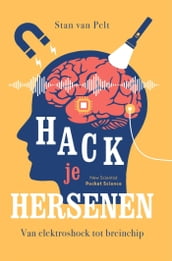 Hack je hersenen