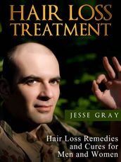 Hair Loss Treatment: Hair Loss Remedies and Cures for Men and Women