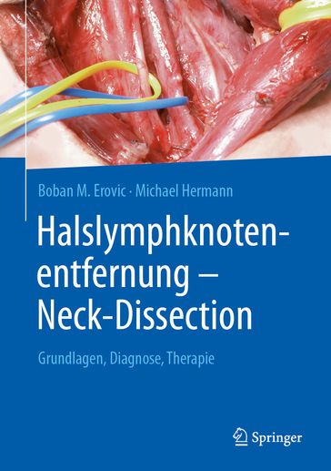 Halslymphknotenentfernung  Neck-Dissection - Boban M. Erovic - Michael Hermann