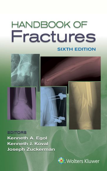 Handbook of Fractures - Kenneth Egol