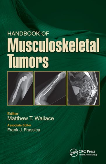 Handbook of Musculoskeletal Tumors - Matthew Wallace - Frank Frassica