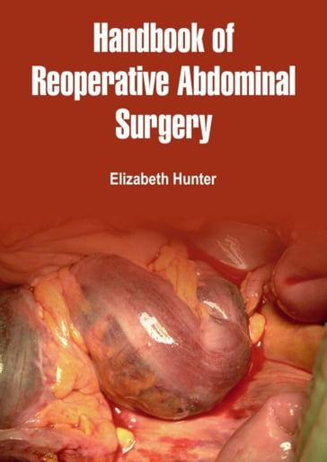 Handbook of Reoperative Abdominal Surgery - Elizabeth Hunter