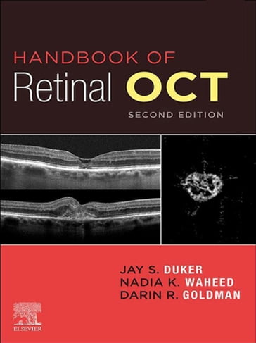 Handbook of Retinal OCT: Optical Coherence Tomography E-Book - MD Jay S. Duker - MD Darin Goldman - MD MPH Nadia K. Waheed