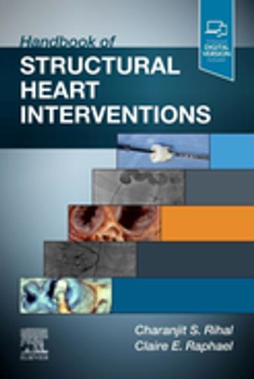 Handbook of Structural Heart Interventions, E-Book - Claire Raphael - Charanjit S Rihal
