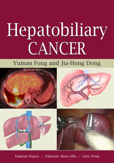 Hepatobiliary Cancer - Yuman Fong