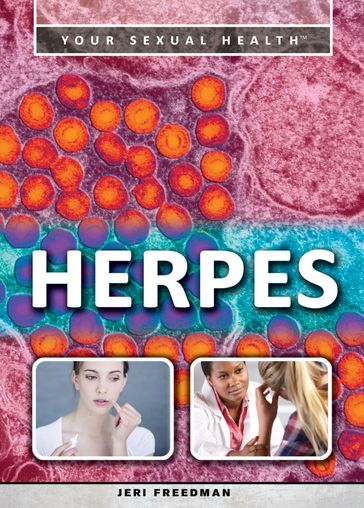 Herpes - Jeri Freedman