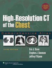 High-Resolution CT of the Chest