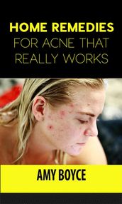 Home Remedies for Acne That Really Works