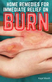 Home Remedies for Immediate Relief on Burns