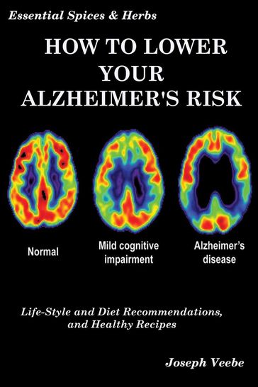 How to Lower Your Alzheimer's Risk: Life-Style and Diet Recommendations and Healthy Recipes - Joseph Veebe