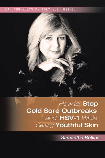 How to Stop Cold Sore Outbreaks and Hsv-1 While Getting Youthful Skin - Samantha Rollins