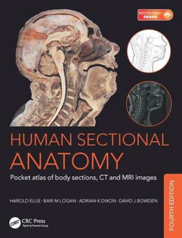 Human Sectional Anatomy - Adrian Kendal Dixon - David J. Bowden - Bari M. Logan - Harold Ellis
