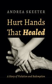 Hurt Hands That Healed