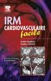 IRM cardiovasculaire facile