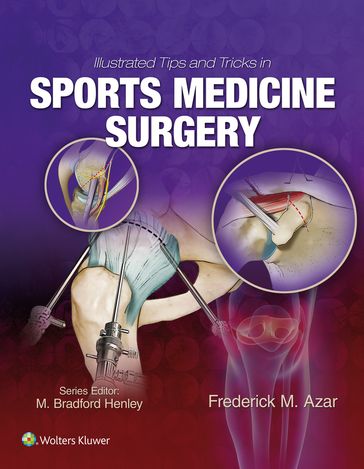 Illustrated Tips and Tricks in Sports Medicine Surgery - Frederick Azar