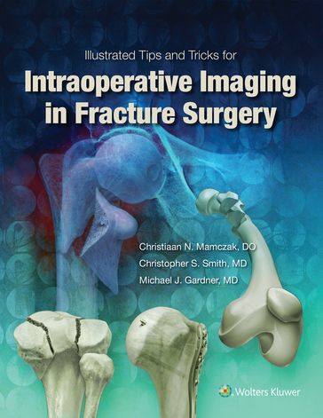 Illustrated Tips and Tricks for Intraoperative Imaging in Fracture Surgery - Michael J. Gardner