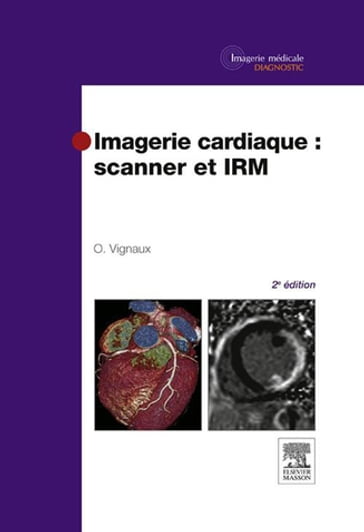 Imagerie cardiaque : scanner et IRM - Olivier Vignaux - Yvette BERNARD - Jean-Michel Bartoli - Salim Benabadji - Jan Bogaert - Jérôme Caudron - Daniel Colombier - Dominique DIDIER - Jean-Nicolas Dacher - Béatrice Daoud - Jean-François Deux - Denis Duboc - Antonin Flavian - Philippe Germain - Gérald Gahide - Jean-Yves Gaubert - Soulef Guendouz - Laurent Huwart - Jérôme JEHL - Alexis Jacquier - Bruno Kastler - Hicham Kobeiter - Pascal LIM - Jean-Pierre Laissy - Matthieu Lapeyre - Angelo Livolsi - Alain Luciani - Julie MAYER - Alain Manrique - Christophe Meune - Jean-Luc Monin - Guy Moulin - Jean-Marc Pernes - Alain Rahmouni - Didier Revel - Jean-Louis Sablayrolles - Emmanuel Salengro - Marc Sirol - Christian Spaulding - Vincent Vidal - Arthur Varoquaux - MD  PhD Pierre Croisille