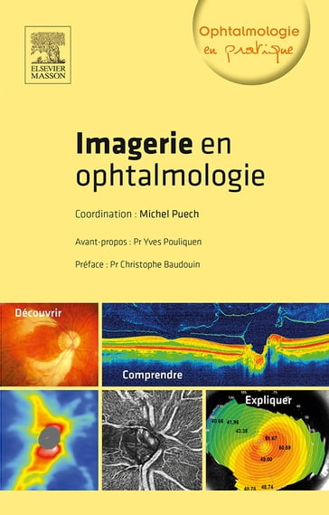 Imagerie en ophtalmologie - Michel Puech