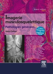 Imagerie musculosquelettique : pathologies générales