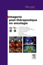Imagerie post-thérapeutique en oncologie